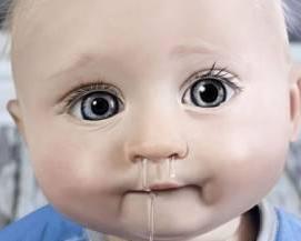 孩子老是流鼻涕,到底是感冒还是鼻炎呢?