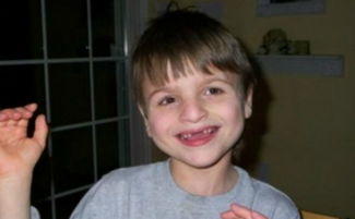 天使综合症孩子能活多久，天使综合症产检能检查出来吗