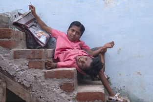 印度连体兄弟脚是谁控制，印度连体兄弟的电影