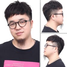 补发和植发的区别，补发价格表大全