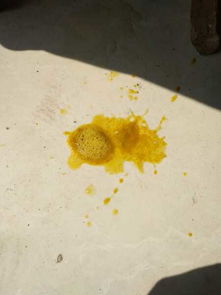 梦见拉屎拉了好多是什么意思，梦见拉屎拉了好多白色的屎