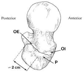 posterior distribution是什么意思