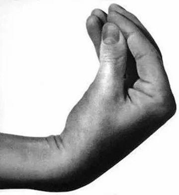 意大利人手势emoji怎么打