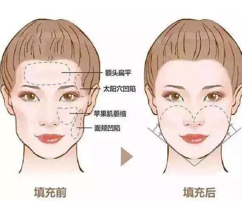 撮合是什么意思，开齐合撮是什么意思