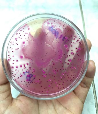 低血钠症的症状和治疗，低血钠症状多久恢复正常