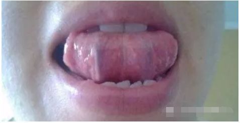 关于舌下神经正确的描述是?