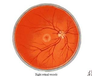 库欣反应的表现为，库欣反应的机制