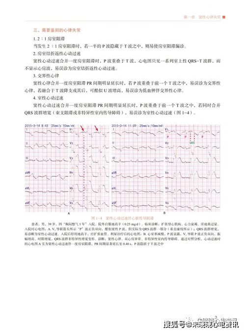 倒置荧光显微镜，倒置式屋面