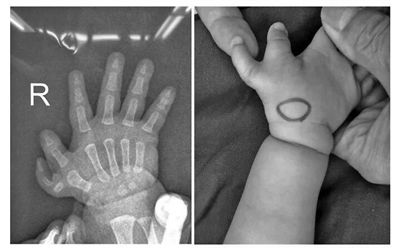 六指是谁?心宅猎人