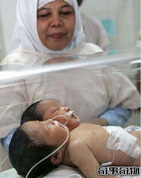 有哪些怪头怪脑人的事例?