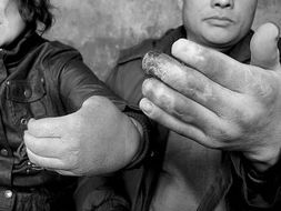 断指属于几级伤残