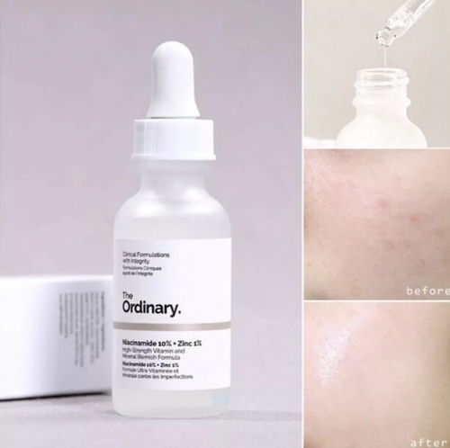 niacinamide 10% + zinc 1% 30ml，niacinamide serum