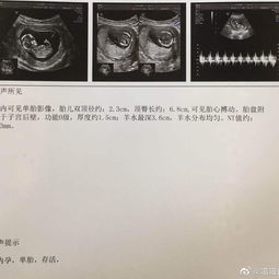 nt检查多少钱，nt$人民币换算器