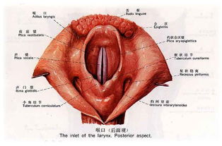 咽白喉吃什么药