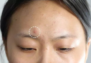 疙瘩怎么读音是什么