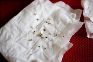 牙石是什么颜色的，牙石是什么原因造成的