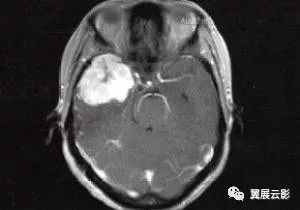 “典型的”的英语翻译