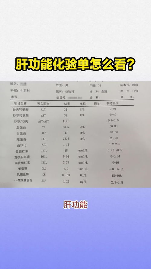 化验单上的肌酐代表什么意思，化验单图片