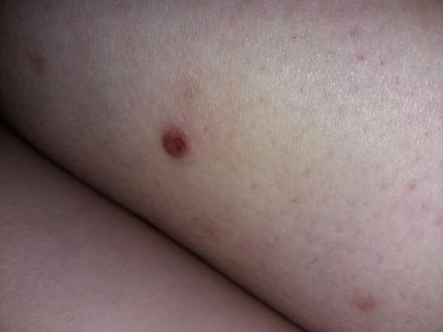 不痛不痒是什么意思,"不痛不痒"的汉语解释