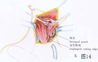 头颈上长小肉球怎办，头颈僵硬是怎么回事