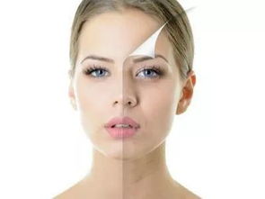 皮肤暗沉是什么意思 皮肤暗沉是什么意思讲解