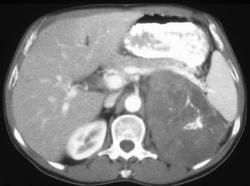 人体的八大系统分别用英语怎么说?