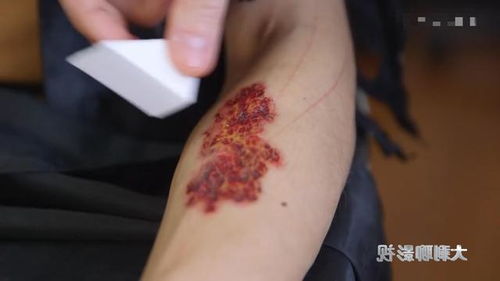 中度烧伤是指烧伤面积，中度烧伤是指多少