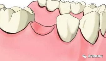 咀嚼怎么读什么意思