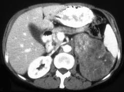 adrenal什么意思，adrenalina